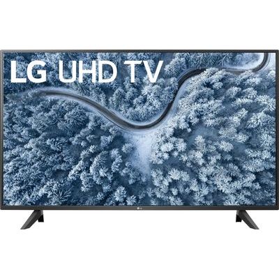 LG 55UP7000PUA 55" Class UP7000 Series LED 4K UHD Smart webOS TV